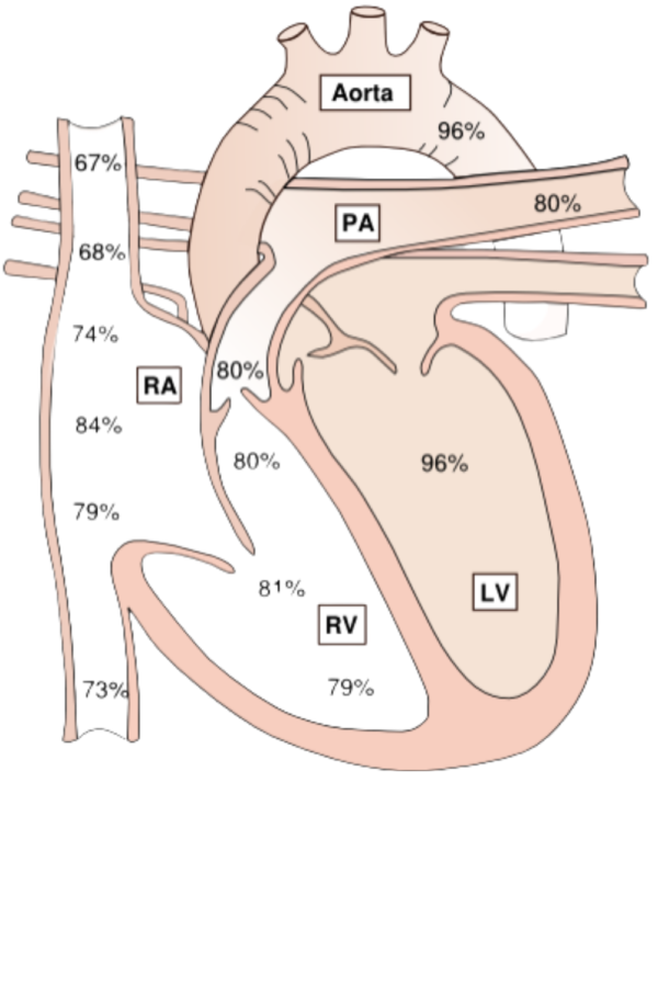 Protocols For Diagnostic Cardiac Catheterization – MedFoxes