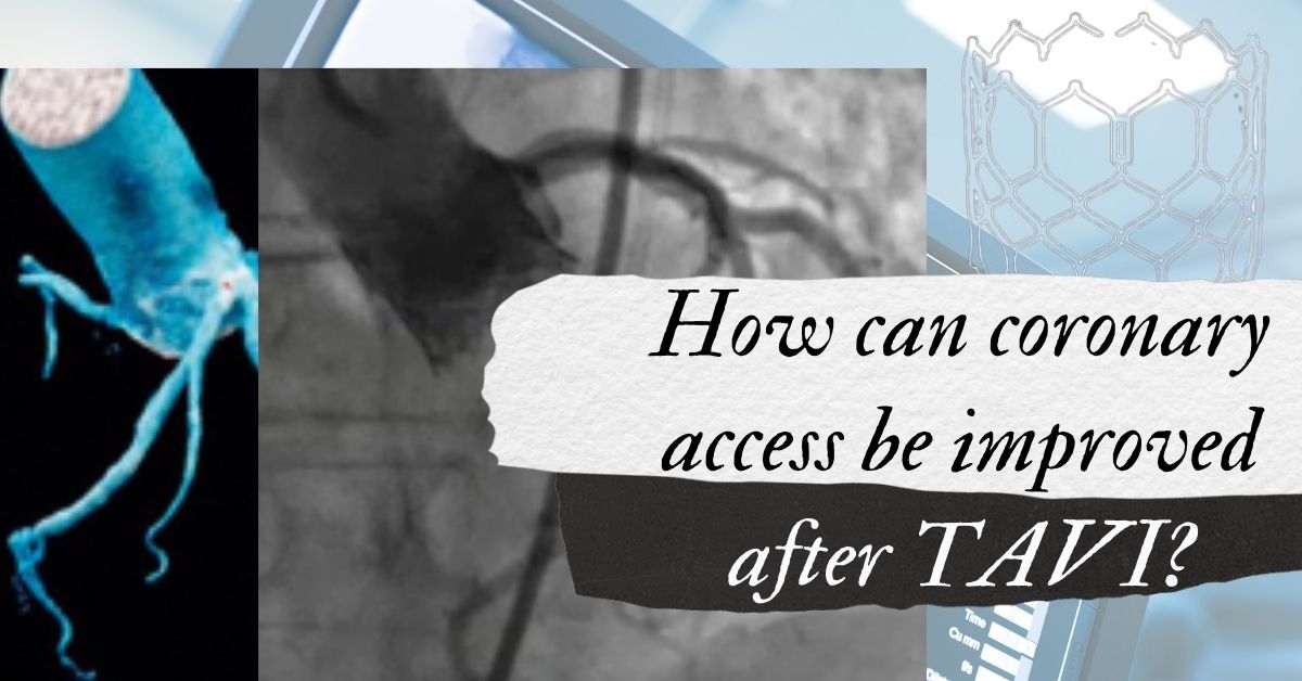 How can coronary access be improved after TAVI?