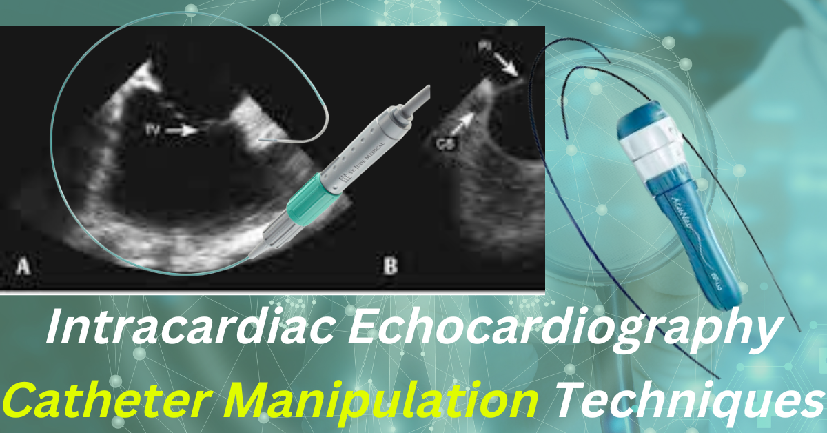 Intracardiac Echocardiography Catheter Manipulation Technique