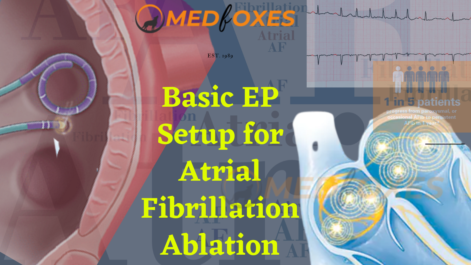 Basic Setup for Atrial Fibrillation Ablation