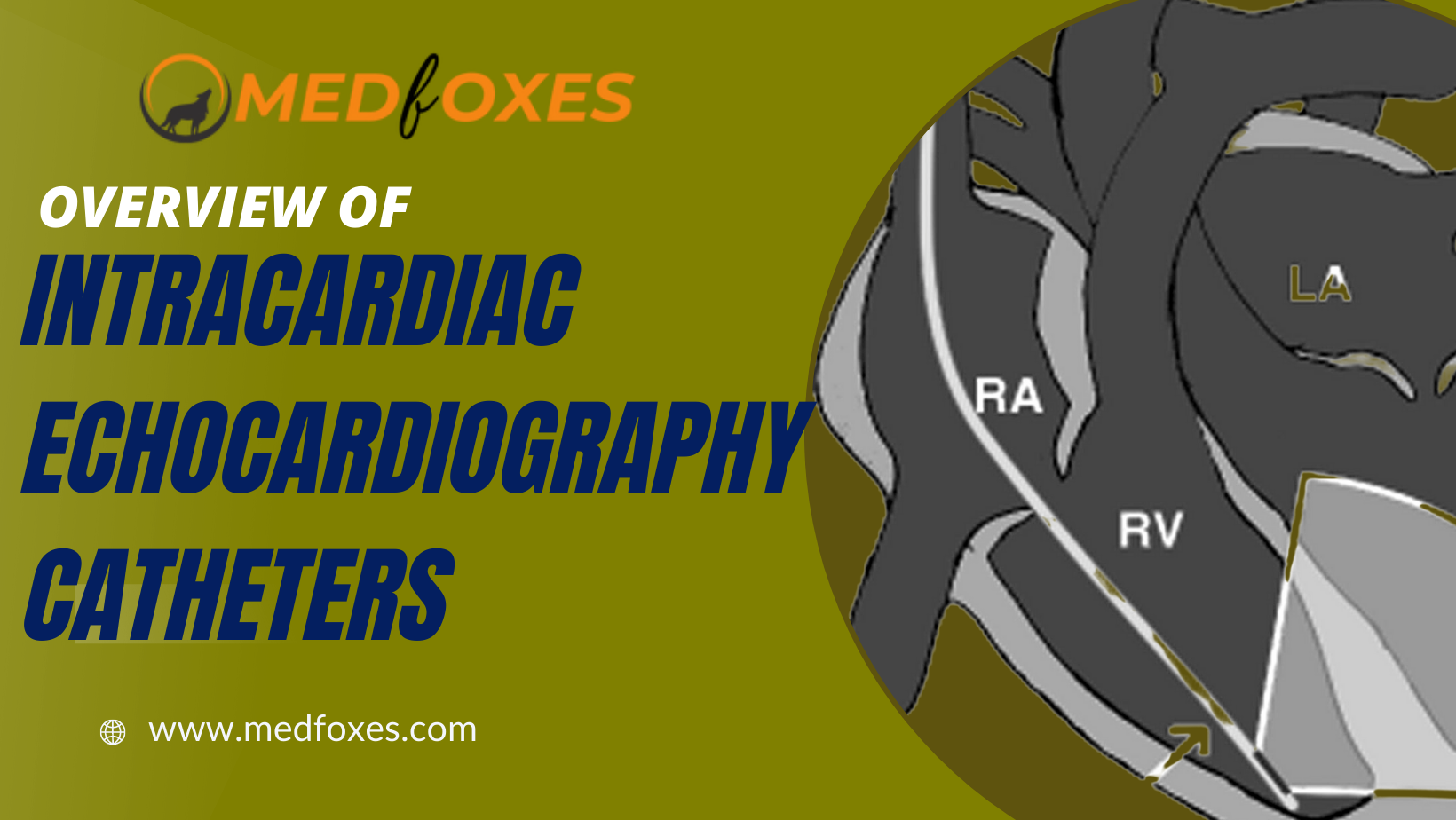 Intracardiac Echocardiography Catheters