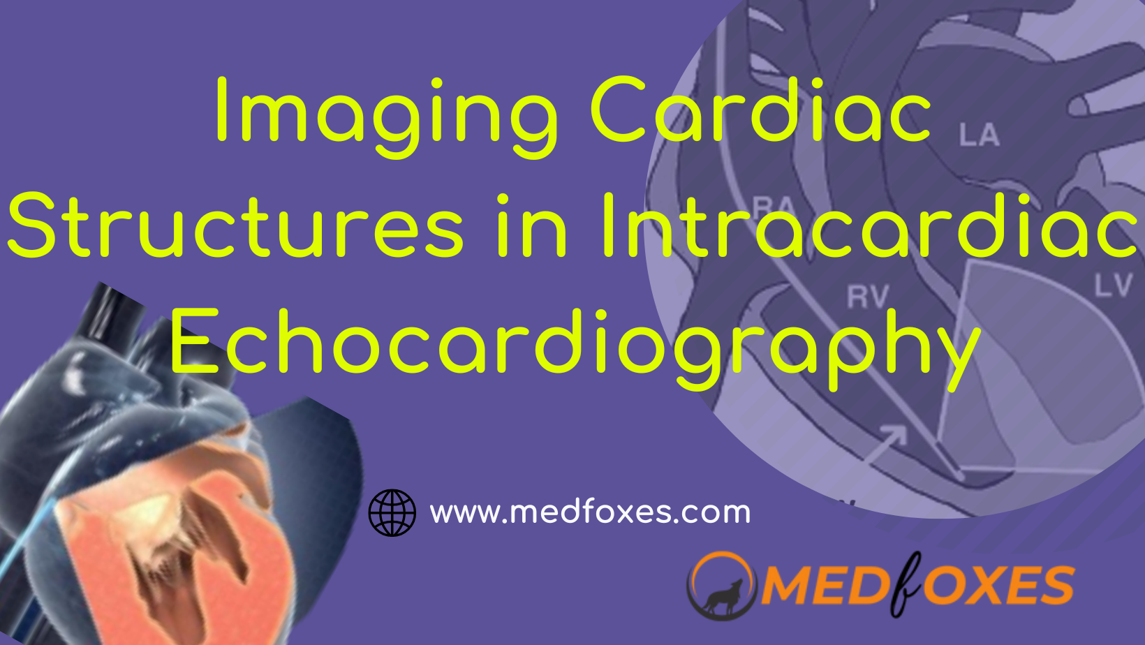 Cardiac Structures in Intracardiac Echocardiography